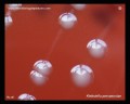 blood agar with non-hemolytic colonies of klebsiella pneumoniae